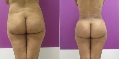 A result from Town Plastic Surgery
