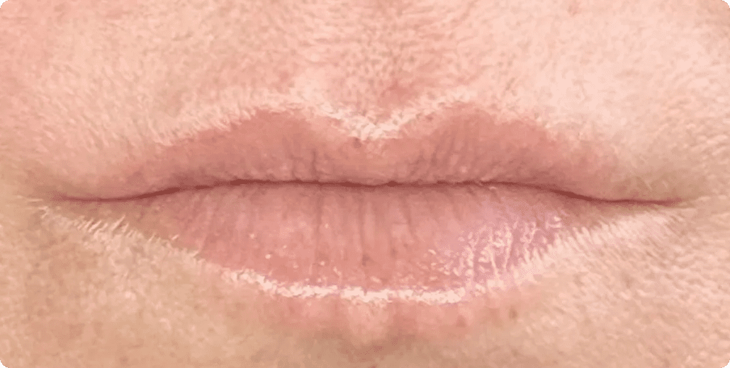 A result from ABQ Medical Spa