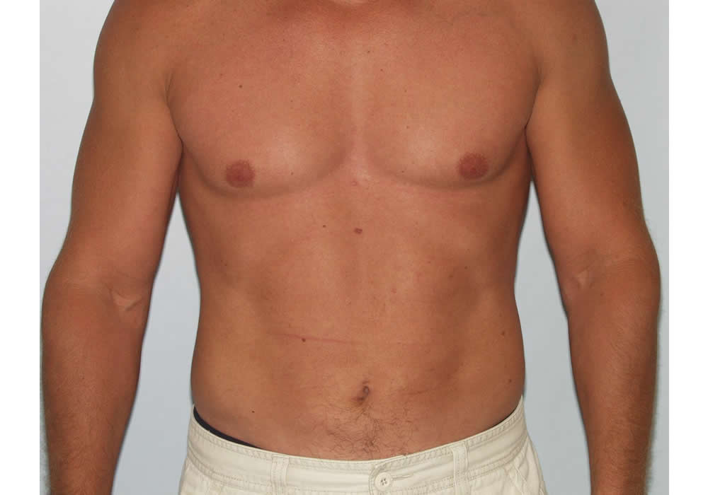 Dr. Ron Soltero FACS provider photo
