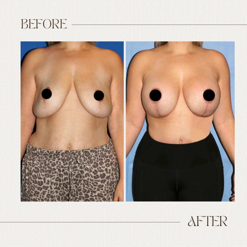 A result from Ashby Plastic Surgery & Aesthetics: Eric R Ashby MD