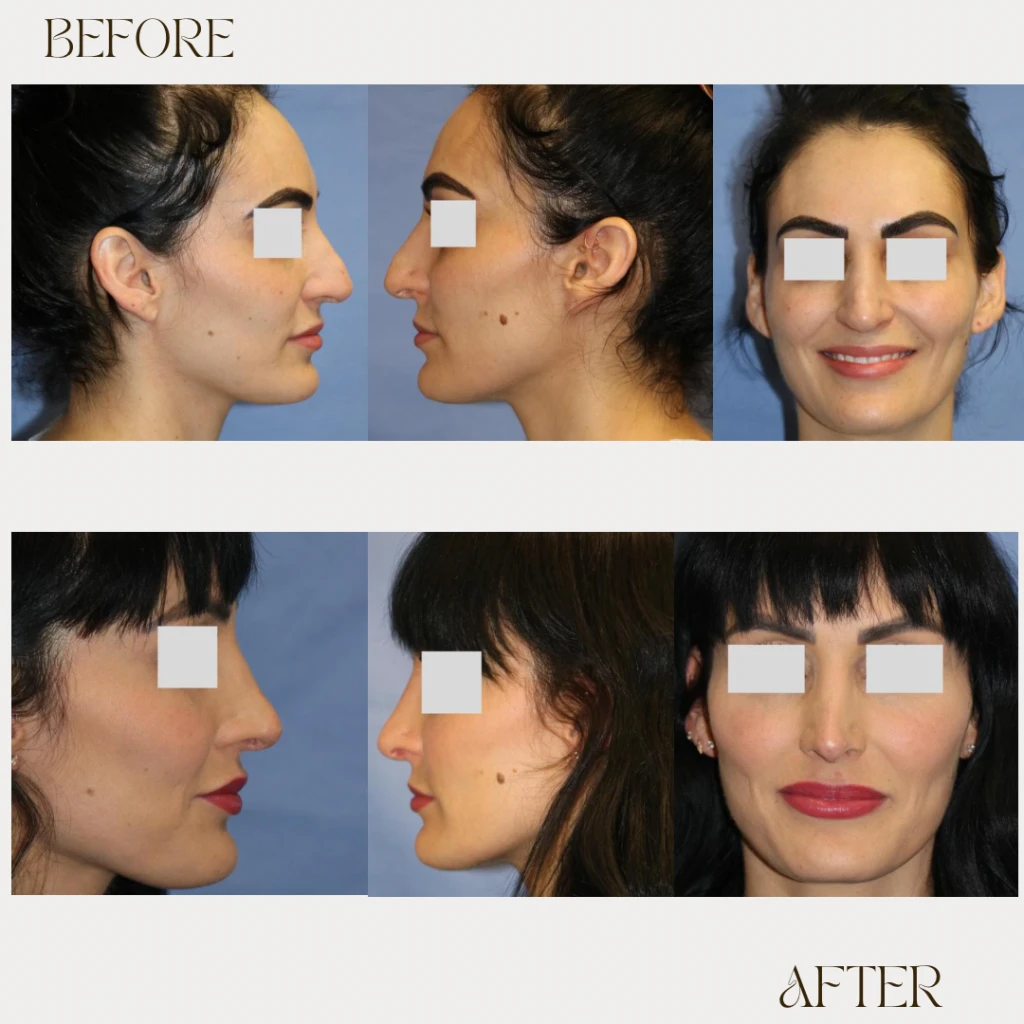 A result from Ashby Plastic Surgery & Aesthetics: Eric R Ashby MD