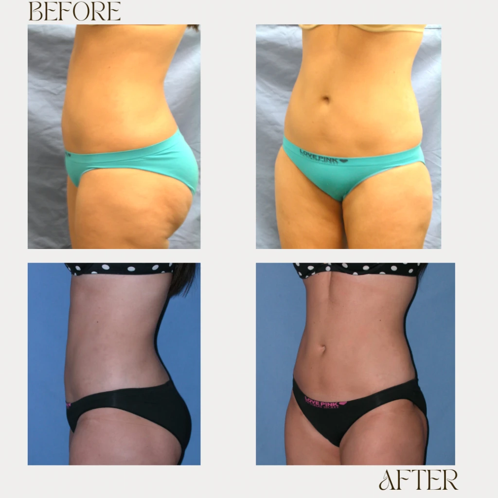 A result from Ashby Plastic Surgery & Aesthetics: Eric R Ashby MD