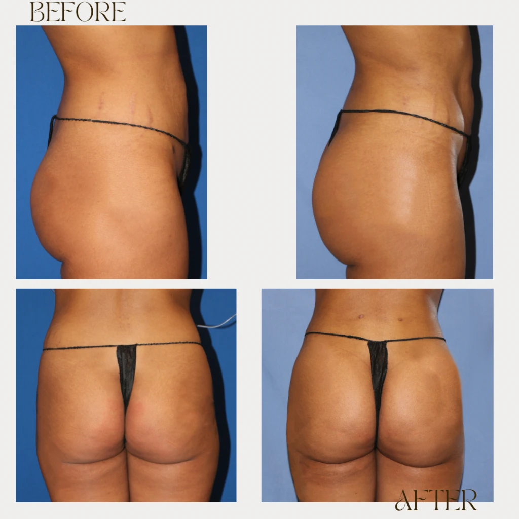 A result from Ashby Plastic Surgery & Aesthetics: Eric R Ashby MD