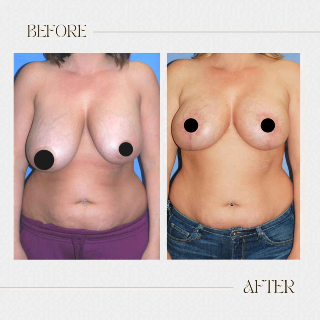 A result from Ashby Plastic Surgery & Aesthetics: Eric R Ashby MD