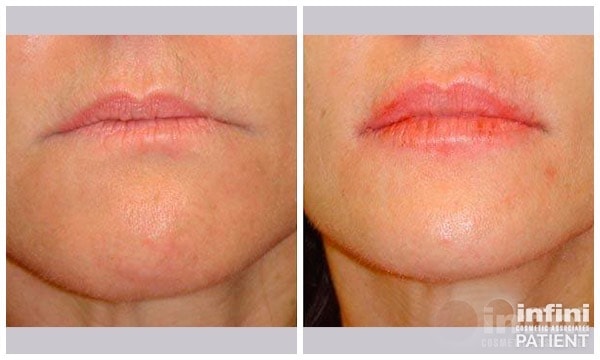 A result from The Plastic Surgeon (Hall)