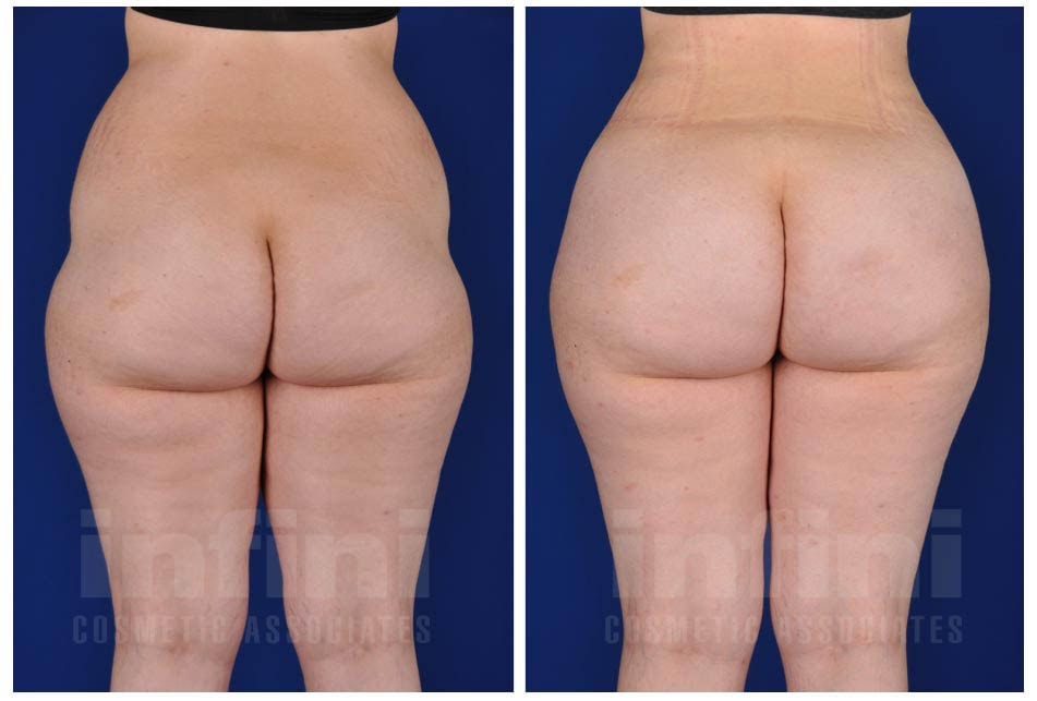 A result from The Plastic Surgeon (Hall)