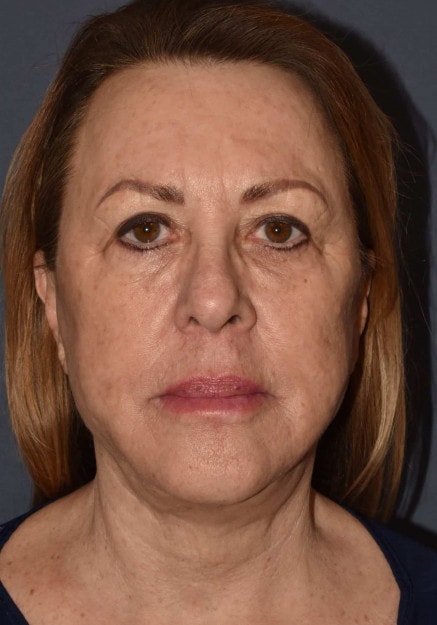 A result from Mark D. Wigod, MD