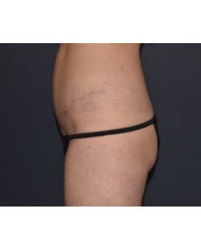 A result from Mark D. Wigod, MD
