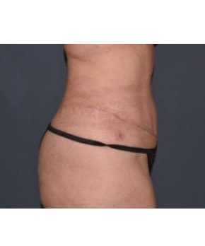 A result from Mark D. Wigod, MD