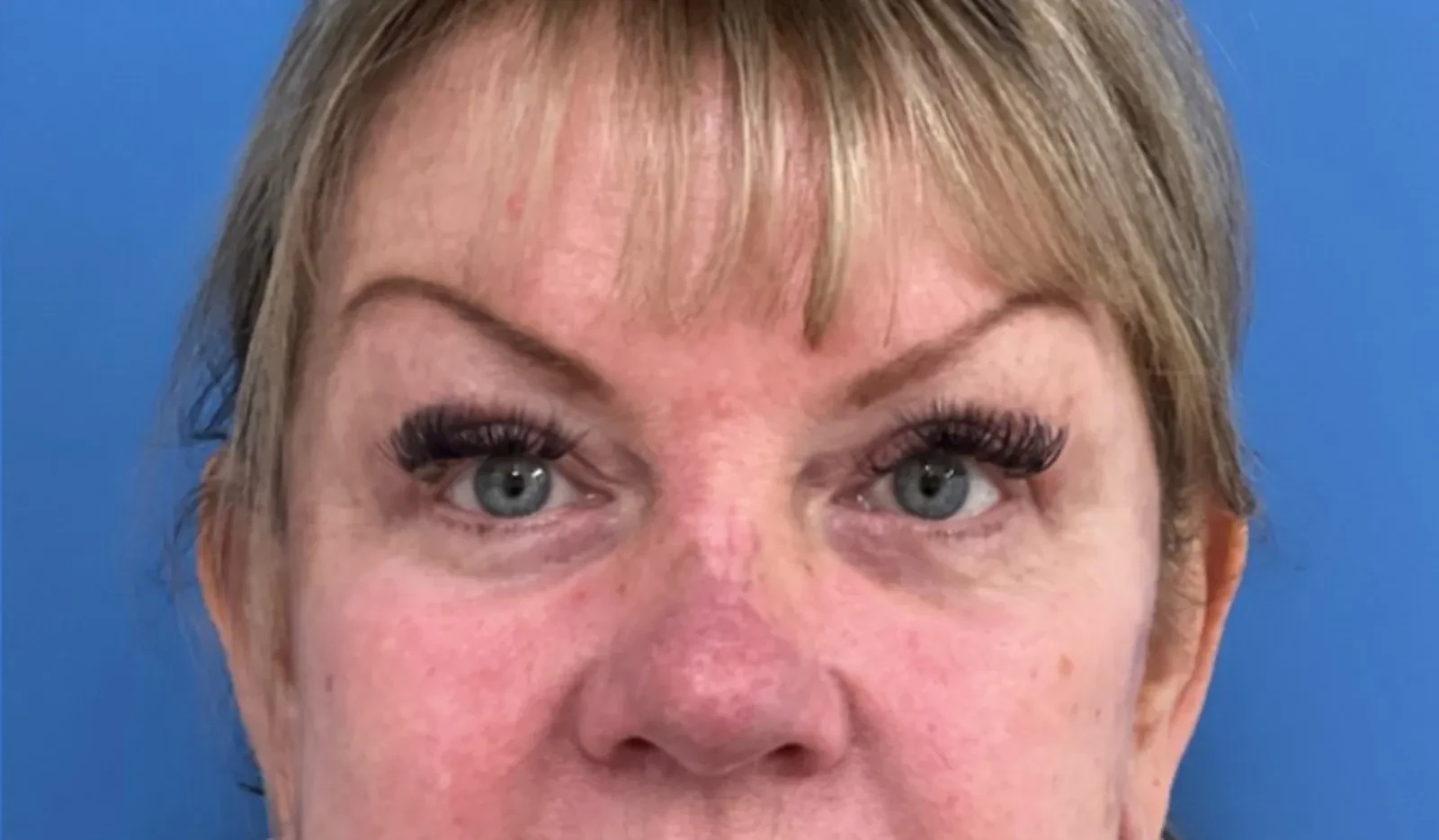 A result from Concierge Aesthetics & Plastic Surgery - Northbrook