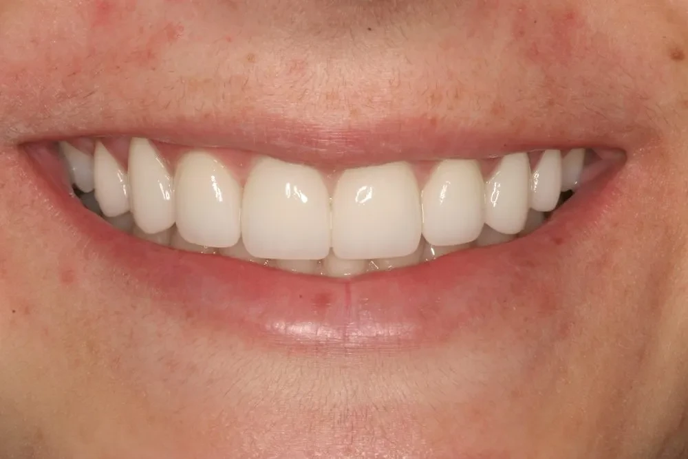 A result from D'Angelo/Olson La Jolla Dentistry