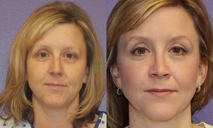 A result from Murphy Plastic Surgery Group