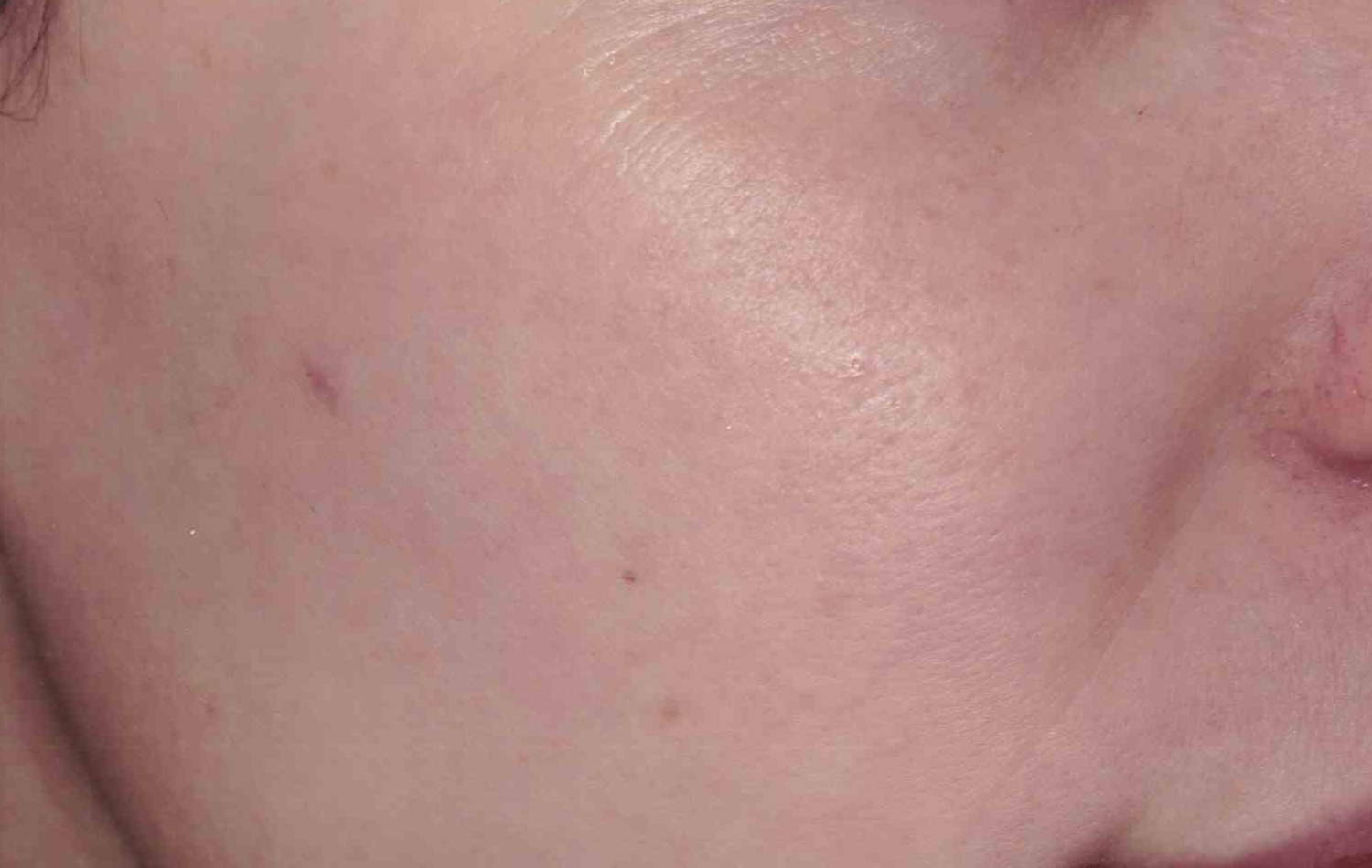 A result from Medical Skin Aesthetics