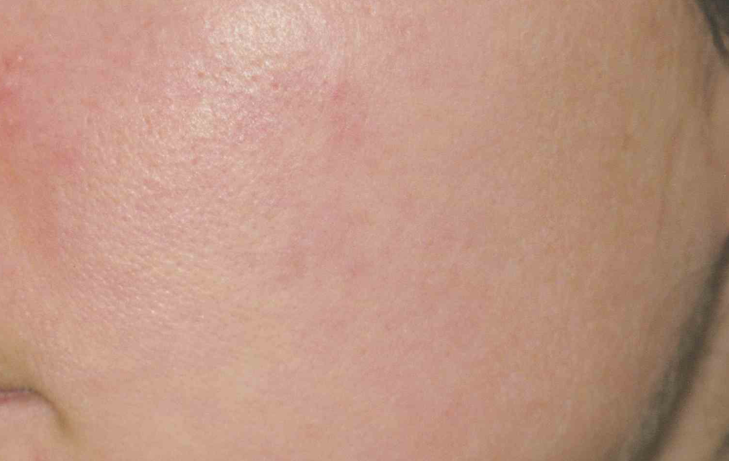 A result from Medical Skin Aesthetics