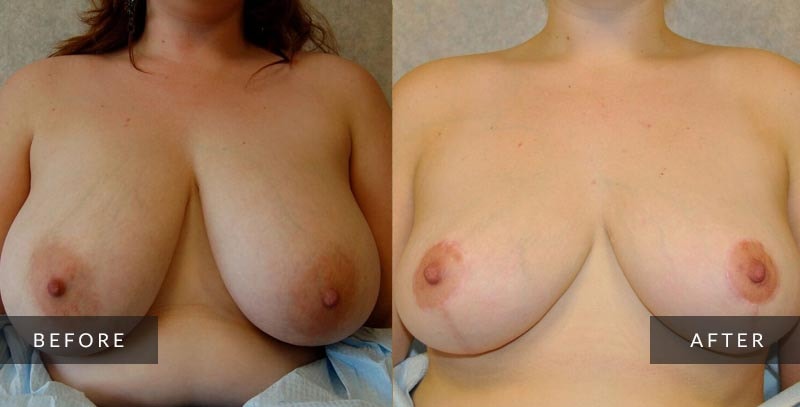A result from Sean A. Wright, MD