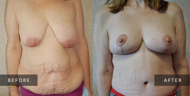 A result from Sean A. Wright, MD