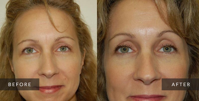 A result from Sean A. Wright, MD