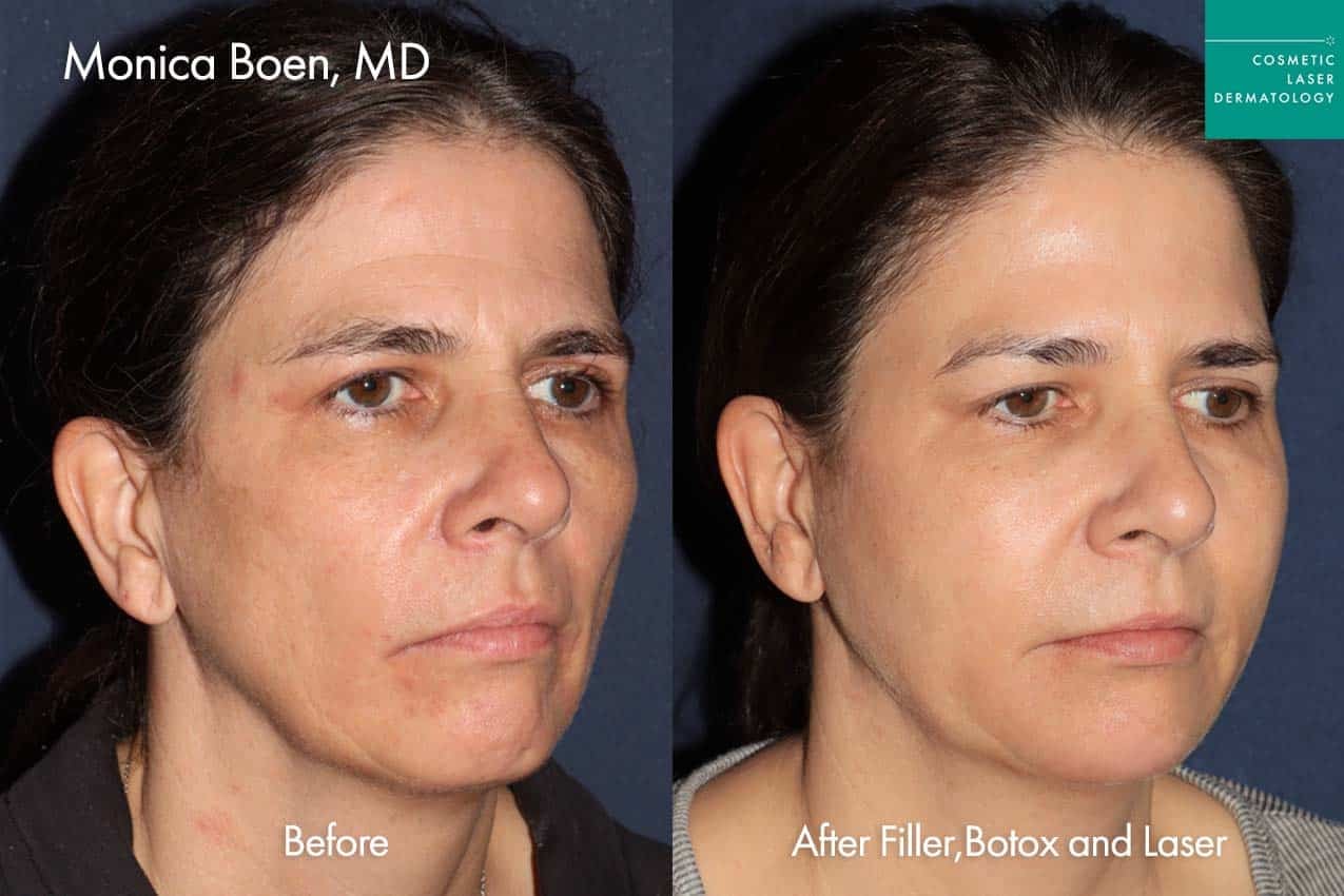 A result from Cosmetic Laser Dermatology