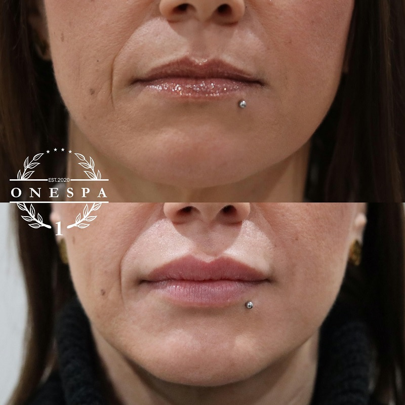 A result from The One Spa Chicago