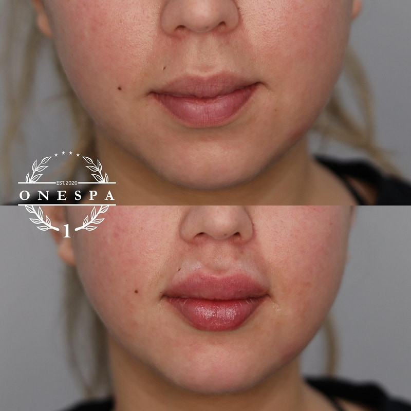 A result from The One Spa Chicago