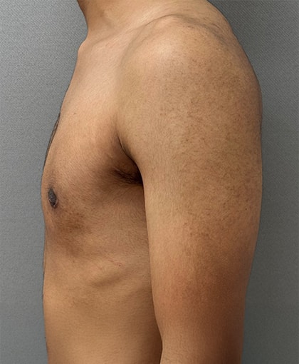 A result from Cosmetic Surgery Associates