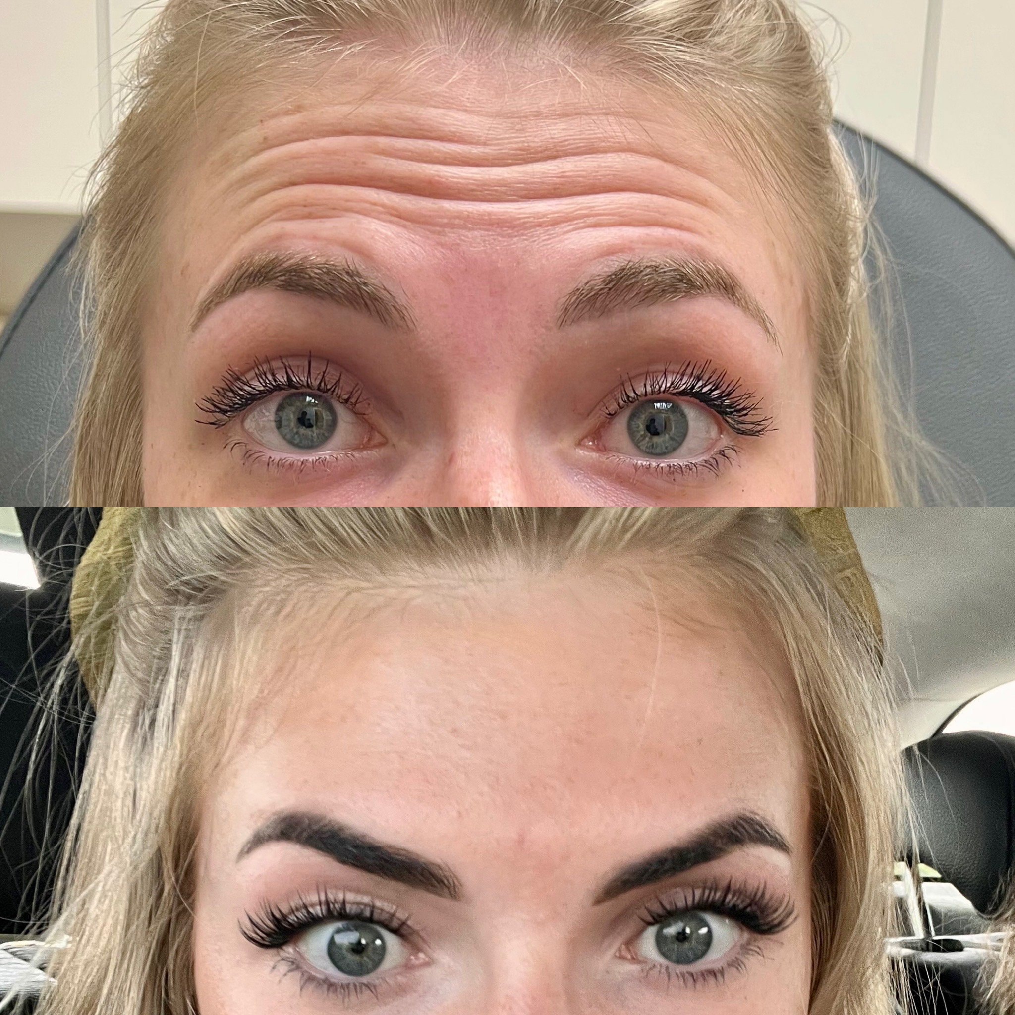 A result from NewSkin MedSpa & Plastic Surgery
