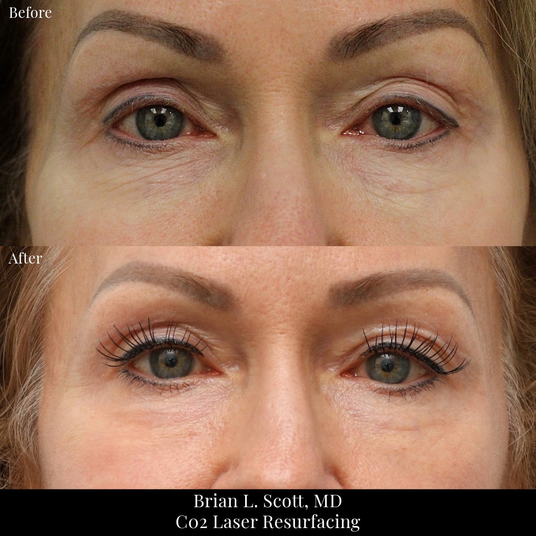 A result from NewSkin MedSpa & Plastic Surgery