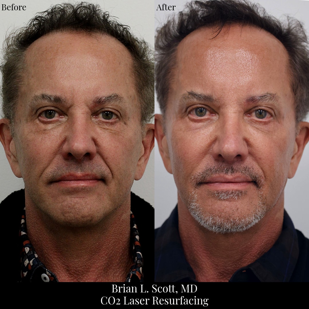 A result from NewSkin MedSpa & Plastic Surgery