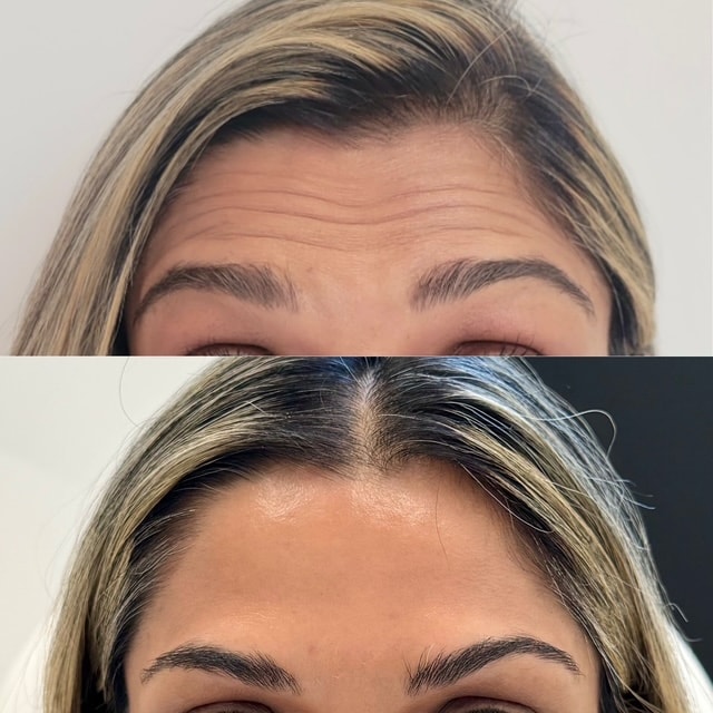 A result from NewSkin MedSpa & Plastic Surgery