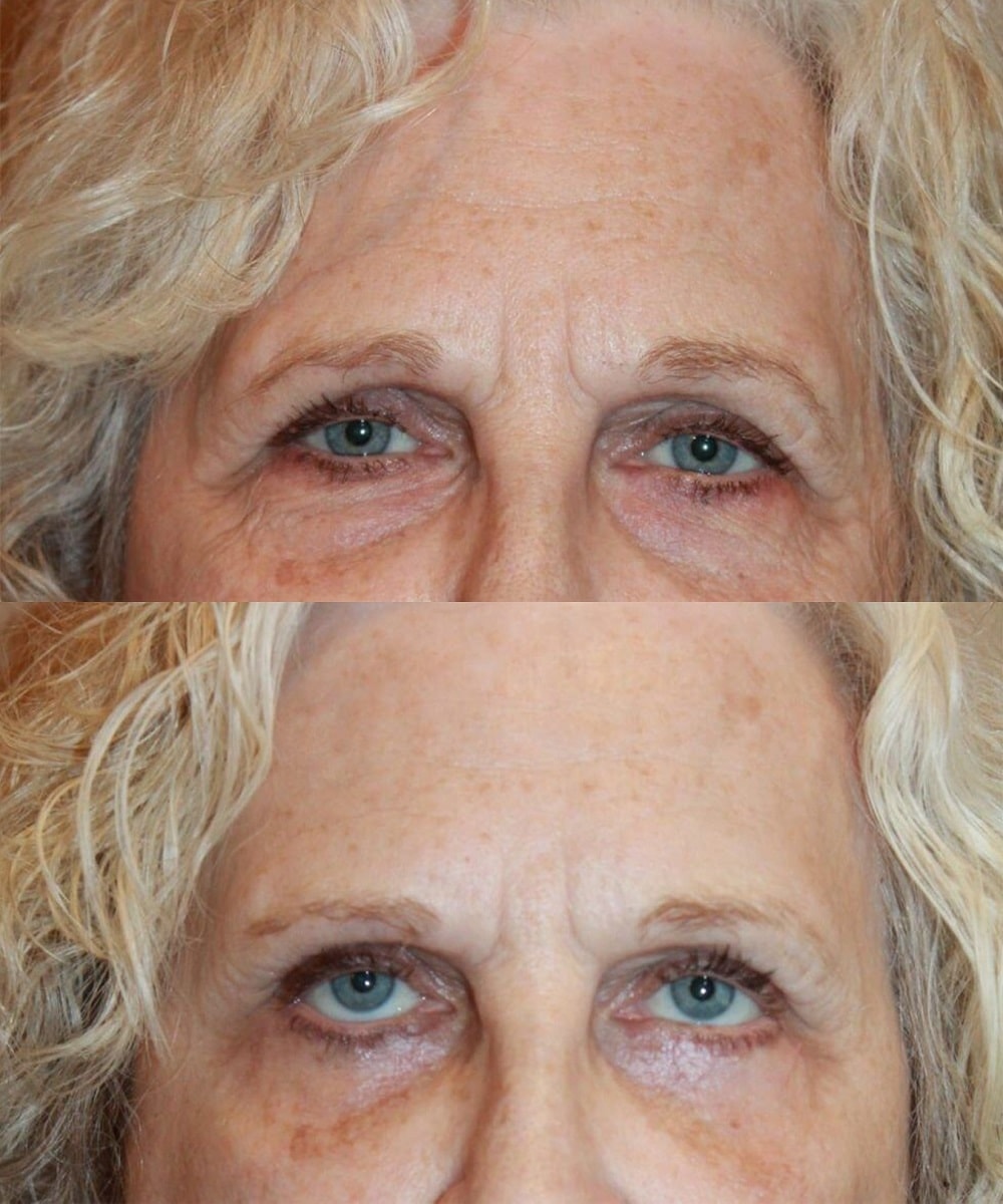 A result from Palmer Cosmetic Surgery