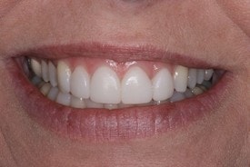A result from St. George Dental Care