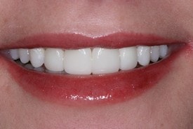 A result from St. George Dental Care