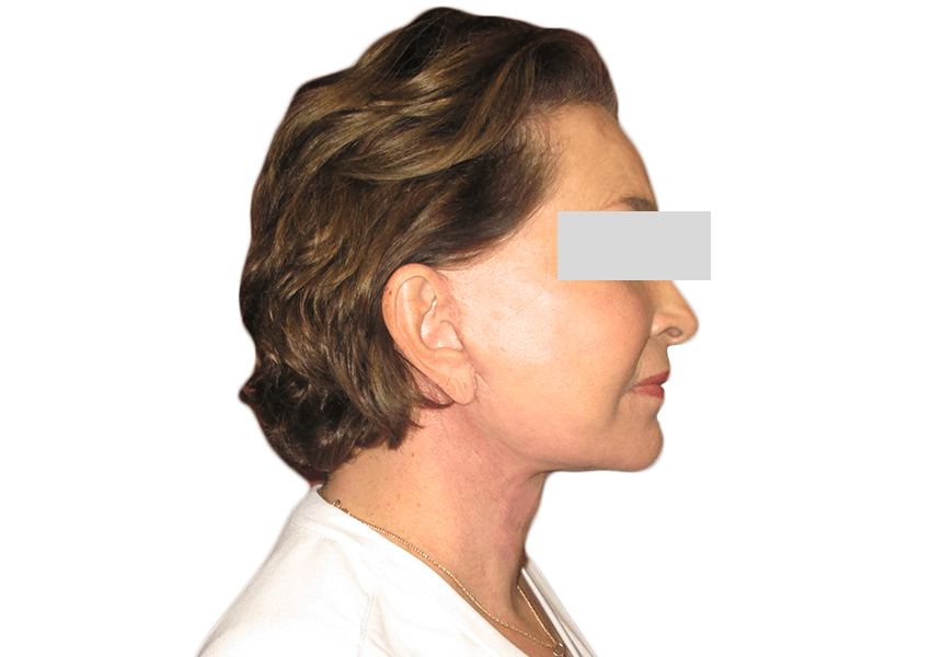 A result from Premiere Surgical Arts