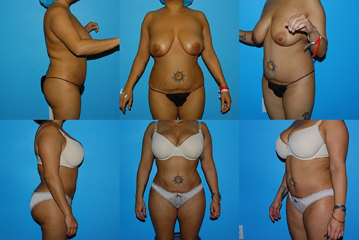 A result from Christian Guzman, MD