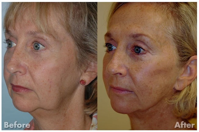 A result from Kirk A. Churukian MD FACS