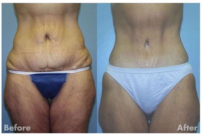 A result from Kirk A. Churukian MD FACS