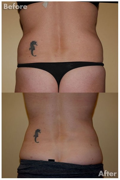 A result from Kirk A. Churukian MD FACS