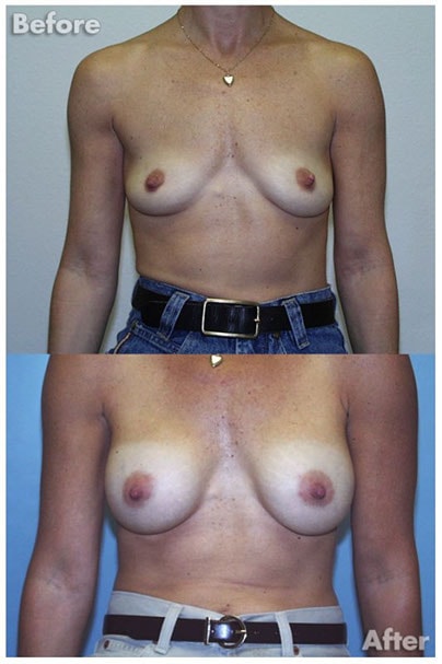 A result from Kirk A. Churukian MD FACS