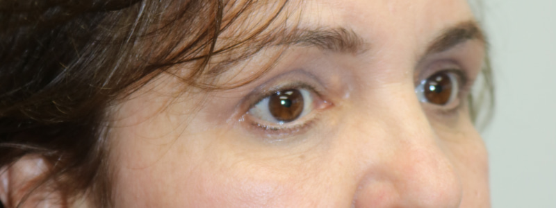 A result from ARC Plastic Surgery