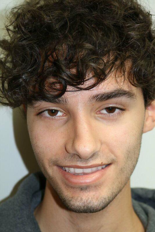 Rhinoplasty before photo