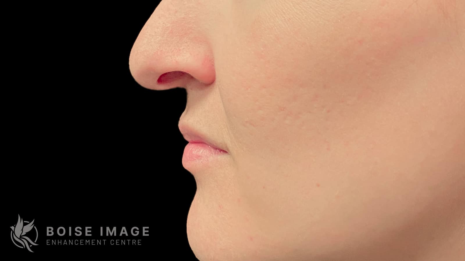 A result from Boise Image Enhancement Center, Inc