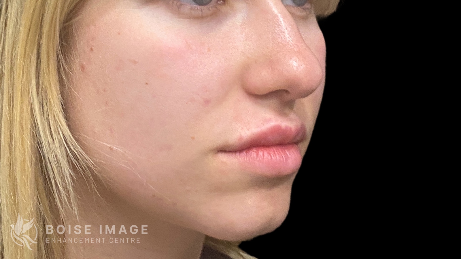 A result from Boise Image Enhancement Center, Inc