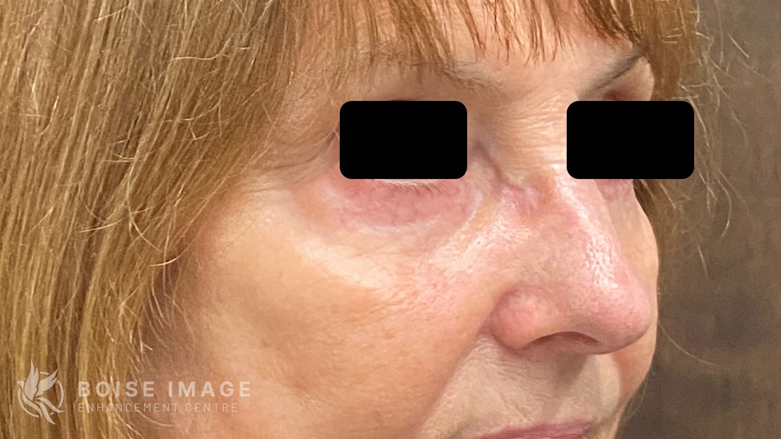 A result from Boise Image Enhancement Center, Inc