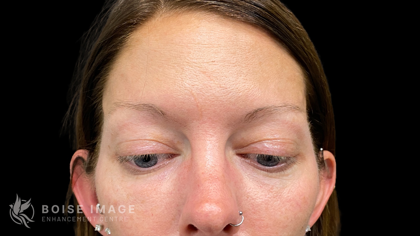 A result from Boise Image Enhancement Center, Inc