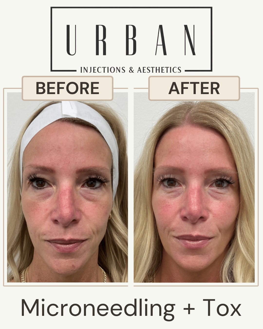 A result from Urban Injections & Aesthetics