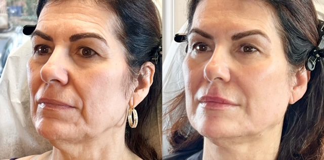 Ferrara Medical Aesthetics provider photo