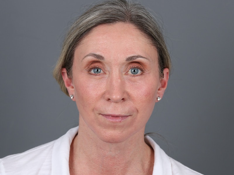 A result from Michael Kim, MD