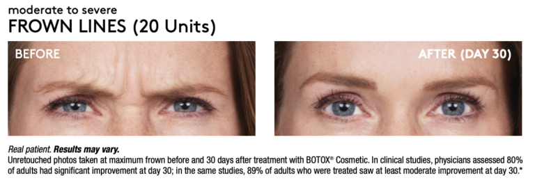 A result from Renew Wellness & Aesthetics
