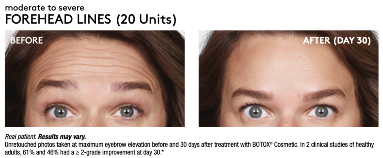 A result from Renew Wellness & Aesthetics