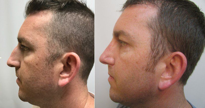 Masri Clinic for Laser and Cosmetic Surgery provider photo